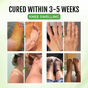 Timilk® CircuZen Anti-inflammatory Balm