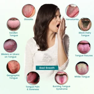 Timilk® GlosShield Zungenreparaturspray