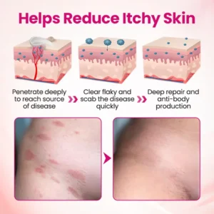 Timilk® IntiDefend Anti-HPV Interferon Gel✅ Blocks High-Risk HPV · Repairs Cervical Tissue · Supports HPV-Negative Results