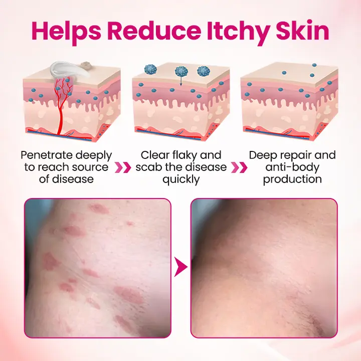 Timilk® IntiDefend Anti-HPV Interferon Gel✅ Blocks High-Risk HPV · Repairs Cervical Tissue · Supports HPV-Negative Results