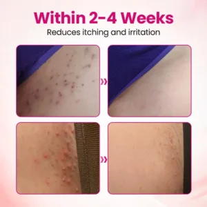 Timilk® IntiDefend Anti-HPV Interferon Gel✅ Blocks High-Risk HPV · Repairs Cervical Tissue · Supports HPV-Negative Results