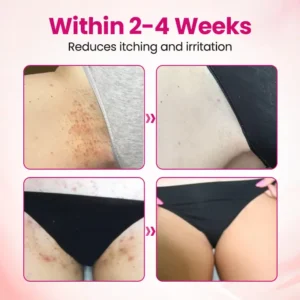 Timilk® IntiDefend Anti-HPV Interferon Gel✅ Blocks High-Risk HPV · Repairs Cervical Tissue · Supports HPV-Negative Results