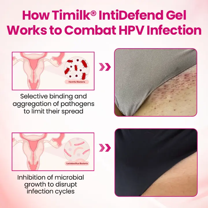 Timilk® IntiDefend Anti-HPV Interferon Gel✅ Blocks High-Risk HPV · Repairs Cervical Tissue · Supports HPV-Negative Results