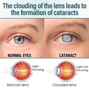 Timilk® OptiFusion Nano Eye Drops Serum —Nano Technology Restores Clear Vision, No Glasses, No Surgery