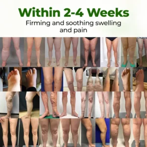 Timilk® Professional Leg Circulation Cream⚕️