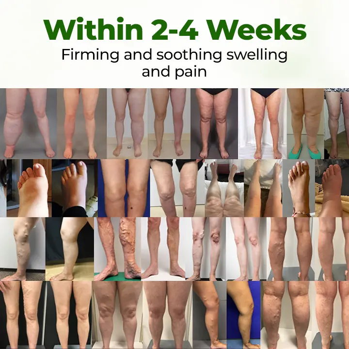 Timilk® Professional Leg Circulation Cream⚕️