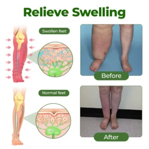 Timilk® Professional Leg Circulation Cream⚕️