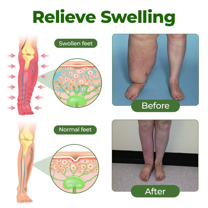 Timilk® Professional Leg Circulation Cream⚕️