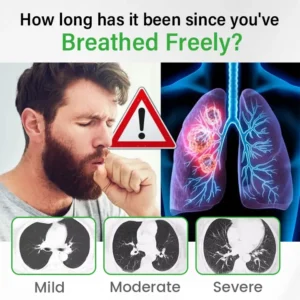 Timilk® Pulmovia Quercetin Lung Detox Inhaler