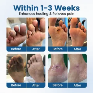 Timilk® AngioVita Diabetic Care Spray