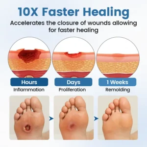 Timilk® AngioVita Diabetic Care Spray