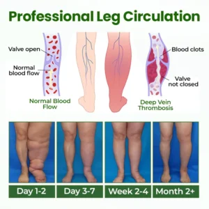 Timilk® BodyRelief Circulation Cream