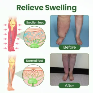 Timilk® BodyRelief Circulation Cream