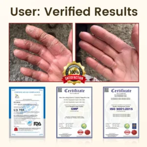 Timilk® DiaRelief Healing Cream