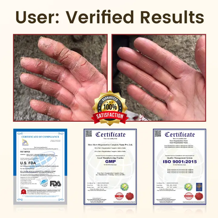 Timilk® DiaRelief Healing Cream