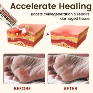 Timilk® DiaRelief Healing Cream