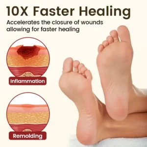 Timilk® DiaRelief Healing Cream