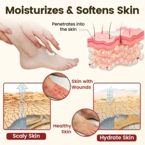 Timilk® DiaRelief Healing Cream