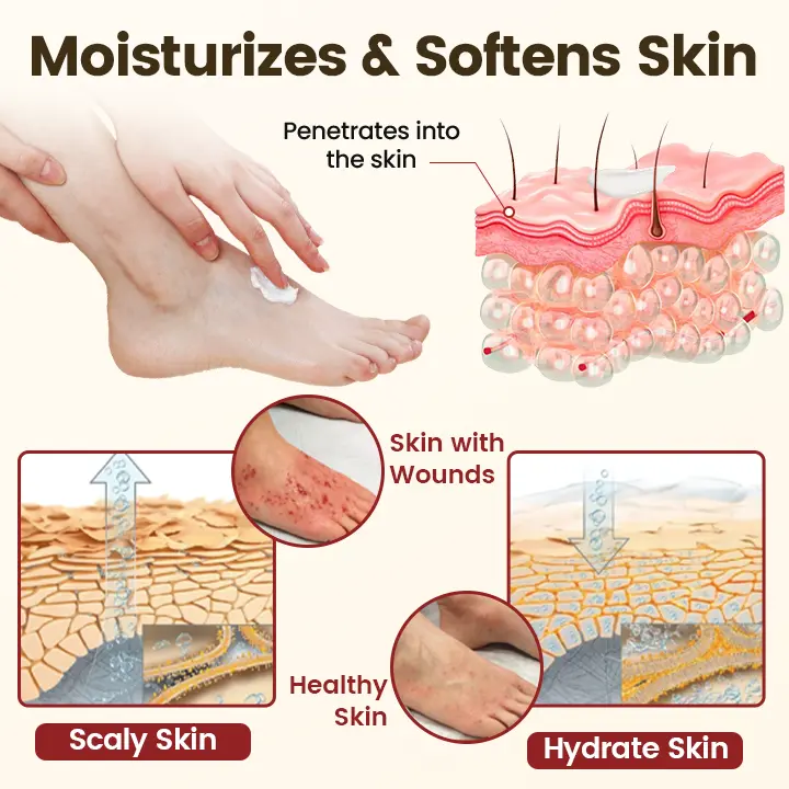 Timilk® DiaRelief Healing Cream