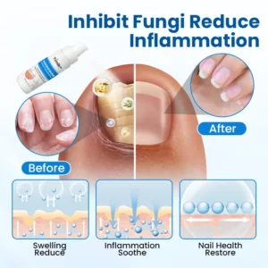 Timilk® Magnesium Herbal Treatment Spray