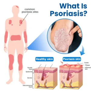 Timilk® Magnesium Herbal Treatment Spray