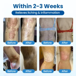 Timilk® Magnesium Herbal Treatment Spray