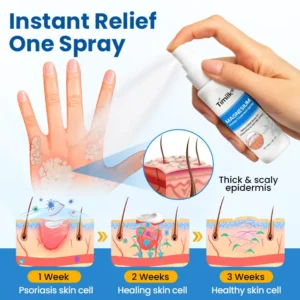 Timilk® Magnesium Herbal Treatment Spray