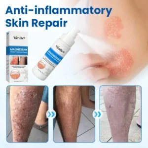 Timilk® Magnesium Herbal Treatment Spray