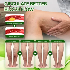 Timilk® SwellRelief Horse Chestnut Edema Cream