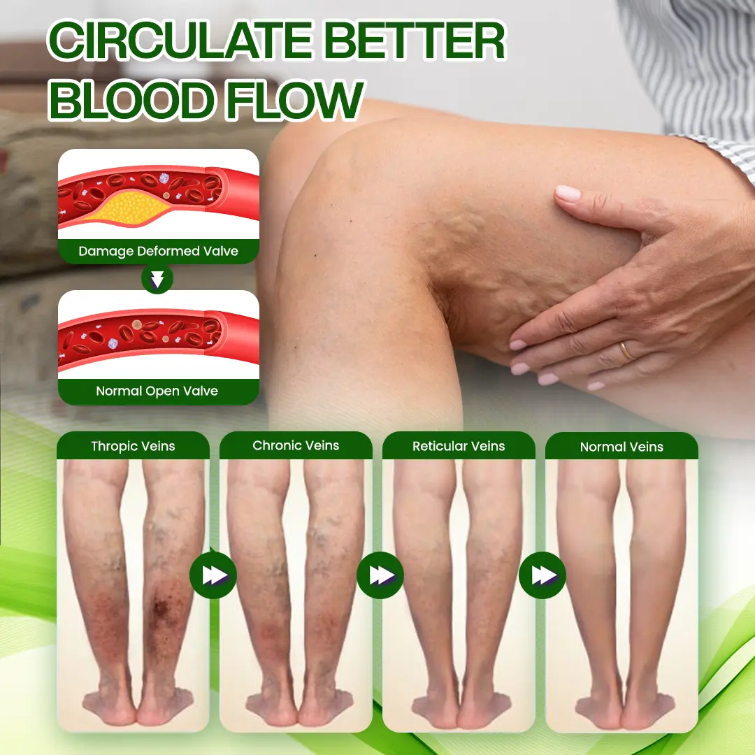 Timilk® SwellRelief Horse Chestnut Edema Cream