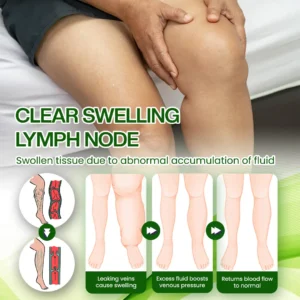 Timilk® SwellRelief Horse Chestnut Edema Cream