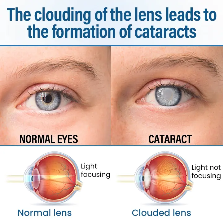 Timilk® VisionReborn Nano Eye Drops