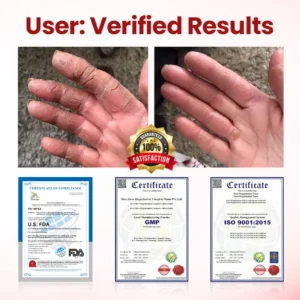 Timilk® VitaGluco Diabetic Care Cream