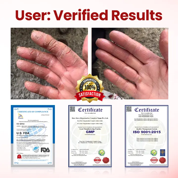 Timilk® VitaGluco Diabetic Care Cream