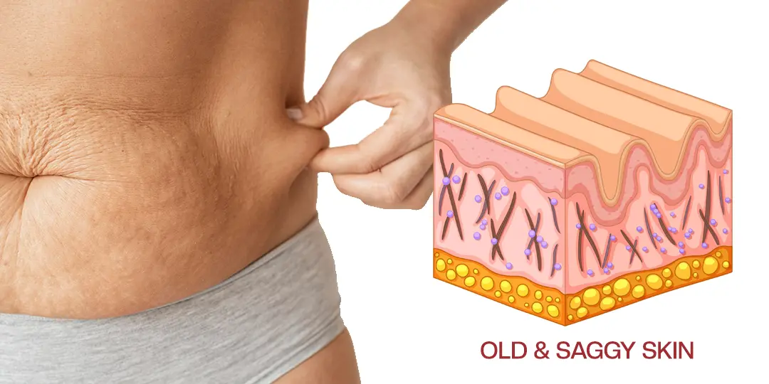 Timilk® AuréLuxe Body Firming Oil 🇬🇧 XH-AuréLuxe-upsell