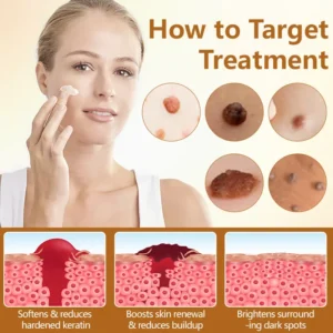 Timilk® BeeErase Multi-Action Renewal Cream 🇬🇧 XH-BeeErase-upsell