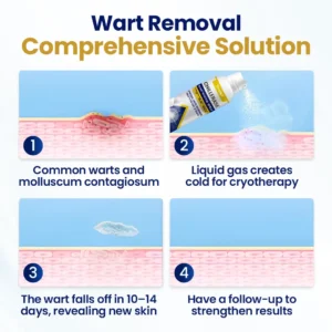 Timilk® ChillErase Bump Renewal Spray (A)