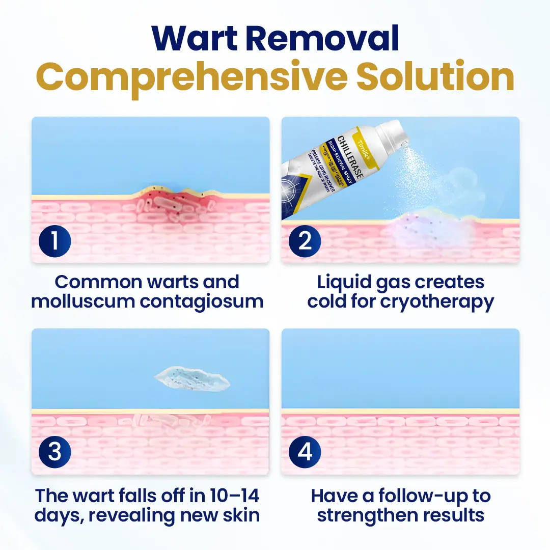 Timilk® ChillErase Bump Renewal Spray (A)