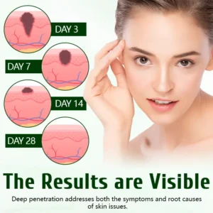 Timilk® DermaPure Tea Tree Healing Cream🔥