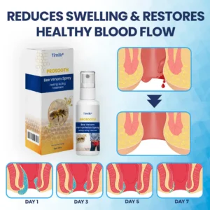 Timilk® ProSooth Bee Venom Hemorrhoids Spray(A)