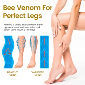 Timilk® VeinClear Bee Venom Cream |✨ Visible Relief in Just 7 Days! 🦵🌿