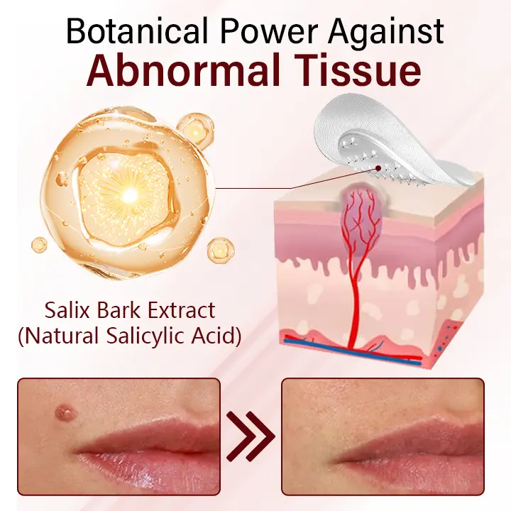 Timilk® Vionara Nano WartErase Patch(A)