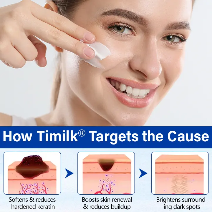 Timilk® WartClear Herbal Ointment 🇬🇧 XH-WartClear-UPSELL