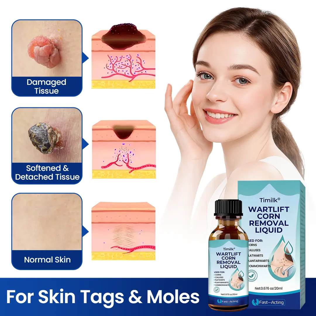 Timilk® WartLift Corn Removal Liquid