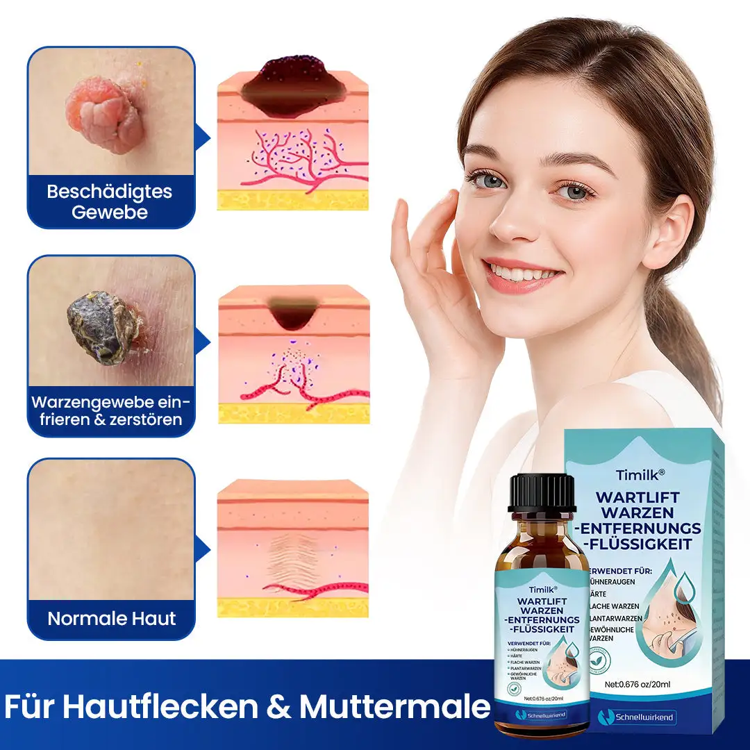 Timilk® WartLift Warzen-Entfernungsflüssigkeit