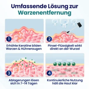 Timilk® WartLift Warzen-Entfernungsflüssigkeit